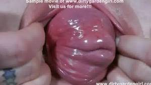 Cervix Dilation Porn - Cervix prolapse extreme pussy dilation dirtygardengirl - Porn Video 501 |  Tube8