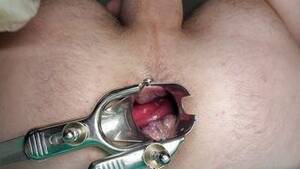 Male Speculum Porn - Speculum Porn â€“ Gay Male Tube