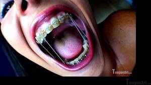 Braces Fetish Porn Tumblr - Braces Mouth Fetish - ThisVid.com
