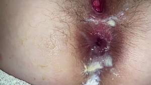 anal fisting hairy - My Slave Wife wants to Anal Fisting. Hairy Pussy & Hairy Huge Asshole.  Close up Anal. Gaping Asshole - Pornhub.com