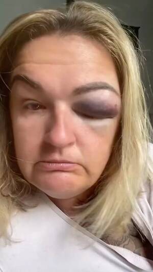 bottomless girls on nude beach - Woman who 'necked' bottomless brunch cocktails faceplants floor after 's***  hit the fan' - Daily Star