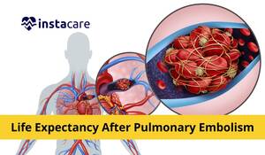 anal thrombosis - What Is Life Expectancy After Pulmonary Embolism?
