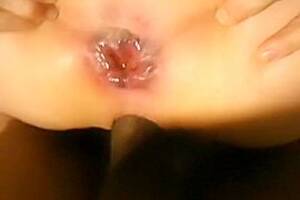 anal sex bruising - Just a sexually sexually excited woman i'd like to fuck anal sex lover  desires me