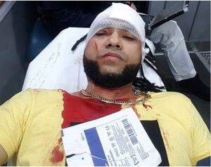 Ashlyn Molloy Fuck - Agreden a cuchilladas al merenguero Mala Fe en el Alto Manhattan â€“ La  Exitosa Radio Monumental 100.3 FM