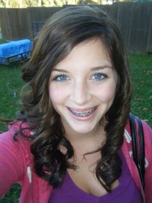 cute teens with braces facial - Cute Teens With Braces Facial - Teen Porn Videos And Free Xxx Movies