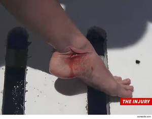 Black Shark Porn - The crew pulled her up to safety, but the shark had done some serious  damage ... it took 20 stitches to close the wound.