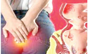 infection from anal sex - Persons engaging in anal sex more at risk of anal cancer, oncologist warns  - Punch Newspapers