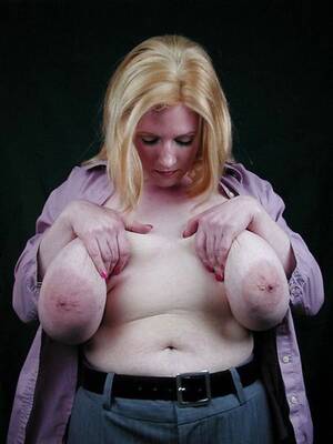 huge deformed boobs - Weird Tits Pics - 67 Ñ„Ð¾Ñ‚Ð¾