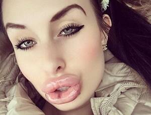Big Lips Porn Stars - Enormous 'porn star lips' on show in terrifying gallery of selfies | The Sun