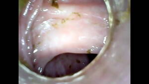 homemade anal insertions - Homemade anal insertion endoscope - XNXX.COM