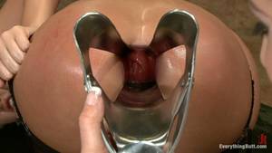 black anal speculum - 