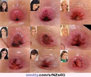 anal gape before after - bigassholes #gaping #bigasshole #analgape #FaceAndAss #beforeandafter # beforeafter #9girls #gape #anus #asshole #assholes | smutty.com