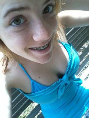cute braces tits - 18 best Cute Girls In Braces images on Pinterest | Bracelets, Braces and  Teeth braces
