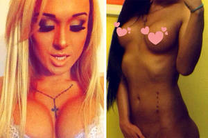 Butt Injections Porn Stars - Mia Maffia