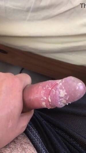 Dick Cheese Porn - Lots of dick cheese smegma - ThisVid.com