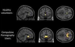 Ay Mind Do You Hae - The Brain Scan That Will Tell If You're Addicted to Porn | GQ