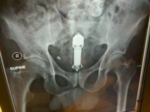 anal object penetration - Anal Object Penetration 88