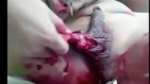 Cutting Off Penis Porn - Search - balls cut off | MOTHERLESS.COM â„¢