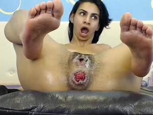 brunette hairy anal - Anal Prolapse Video | Perverted Hairy Brunette Dildo Fuck In Ruined Anal  Rosebutt - Release October 05, 2017