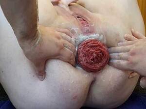 homemade anal prolapse - Asshole Fisting | Mature Fisting - Homemade Monster Anal Prolapse Loose  During Fisting DP