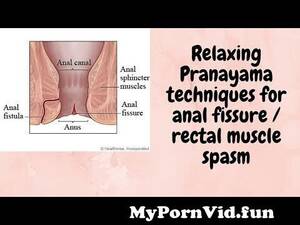 Anatomy Anal Porn - Pranayama or Breathing Techniques for Anal Fissure or Anal Fistula pain.  from yoga anal com Watch Video - MyPornVid.fun
