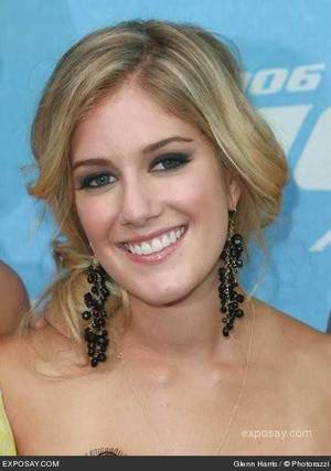Heidi Montag Hairy Pussy - heidi montag surgery