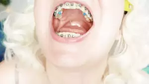 Braces Fetish Porn Tumblr - braces fetish: close up video mukbang | xHamster