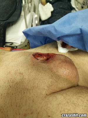 Cock Cut Off - CrazyShit.com | Dude With No Balls Cuts Off His Dick. - Crazy Shit