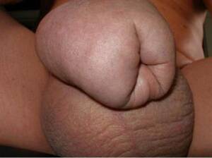 Bizarre Dick Porn - Free Porn Penis, Bizarre Pics - Pichunter