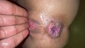 hemorrhoids from anal sex - TMD: Queen Devil's Nasty Anal Sex! (Free Scene) - Free Porn Videos - YouPorn