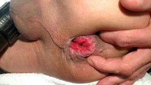 Anus Fetish Porn - My lovely anus - fetish porn at ThisVid tube