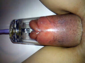 Extreme Bizarre Pussy - Girl's extreme pussy pumping - bizarre porn at ThisVid tube