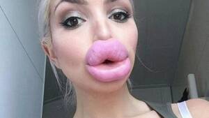 Botox Lips Porn - Terrifying pictures show worrying trend of 'porn star lip fillers' - Mirror  Online