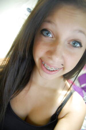 Braceface Porn Captions - Brace Face Cumdump Teens - 8 photos