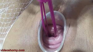 Fuck My Cervix - Mature wife fucking cervix and penetration in uterus with knifes -  XVIDEOS.COM