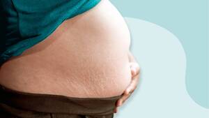 misshapen pregnant belly - What Is a B Belly During Pregnancy and Why Does It Happen?