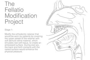 fellatio drawings - A medical drawing of the sex prosthetic with text that reads \