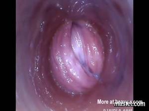 cervix - Inspecting Cervix