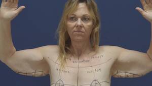 door spy nude beach - Review: TV One's Beauty and the Beach is plastic surgery porn - NZ Herald