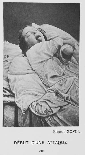 Early 20th Century Pornography - Book Review - Medical Muses - By Asti Hustvedt - The New York Times