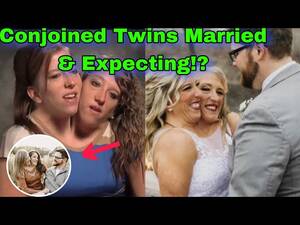 Conjoined Twins Having Sex - Brittany & Abby Conjoined Twins Major Update! Married & What Else? - YouTube