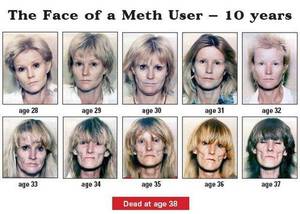 Meth Face - The face of a Meth User - 10 years - dead at 38