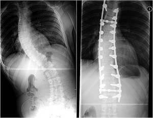 Famous Toon Xray Porn - 