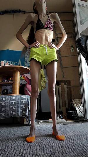 Anorectic Porn - Anorexic Ariadne 01-08-2022