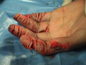 Gross Disgusting Porn - itt: post the grossest most disgusting and horrible pictures you have ever  seen (no vids!)