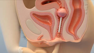 Cartoon Lollipop Porn - Horny Teen Masturbating With lollipop - xray porn - Hentai City