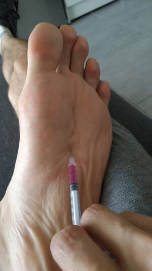 foot heel bruise - Bare feet afternoon B12 injection 4/4 - ThisVid.com