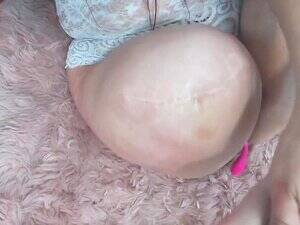 Amputee Porn Real Homemade - Amputee porn videos at Xecce.com