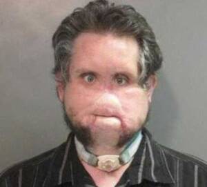 Disfigured Porn Sex - Disfigured pedophile got hooked on child porn while hiding away indoors |  Metro News