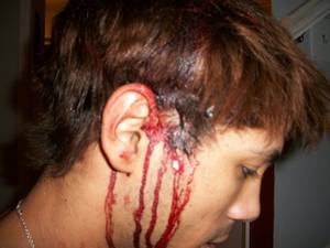 Brutal Gay Porn Robin - Gay bashing ...